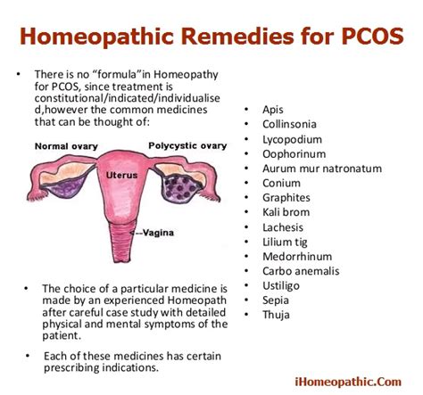 Polycystic Ovarian Syndrome Treatment In Homeopathy Homeopathic