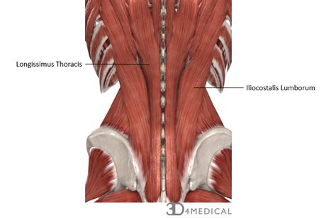 The muscles, bones, ligaments, and tendons in the back can all be injured and cause back pain. Muscles - Advanced Anatomy 2nd. Ed.