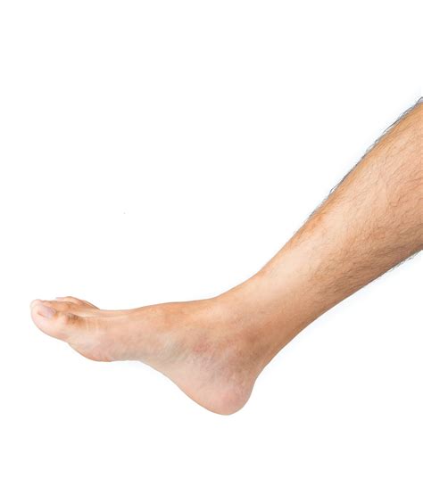The Dreaded Cankle Defined What Are They And How Do I Treat Them In La