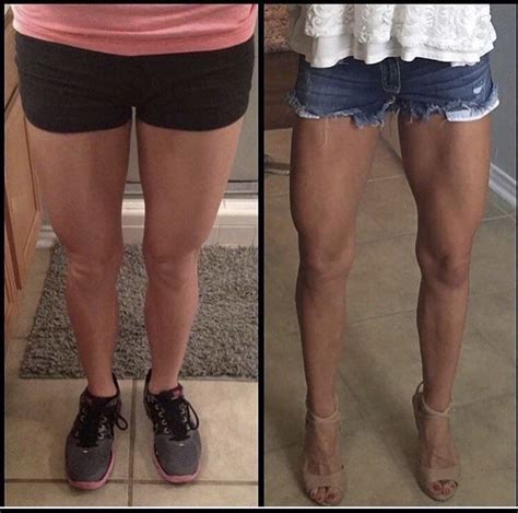 toned legs before and after