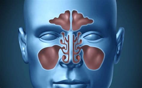Sinus Infection Sinusitis Causes Symptoms And Treatment Options
