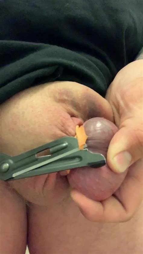 Band Removal From Testicle