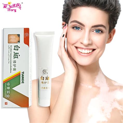 Ifory 30g Chinese Vitiligo Cream White Spot Antibacterial Cream Pigment