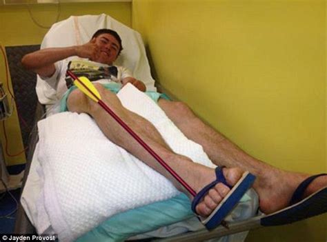 Man Shoots Himself In Leg With Crossbow And Then Hops 1km To Safety Daily Mail Online