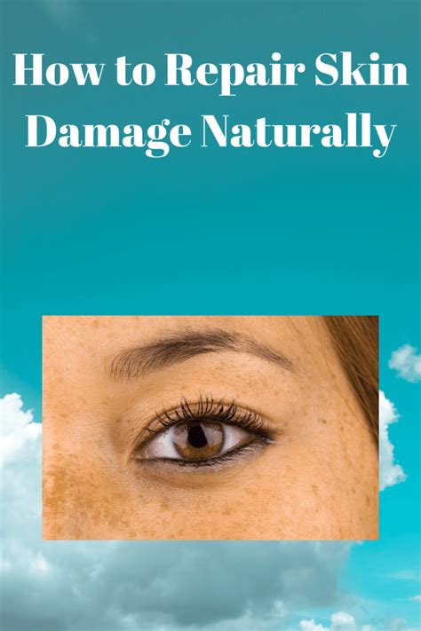 How To Repair Skin Damage Naturally Fast Life Tips