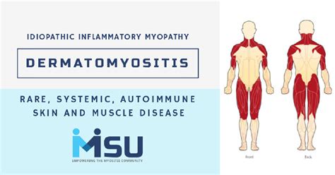 Dermatomyositis Myositis Support And Understanding