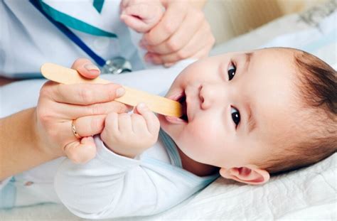 Tonsillitis In Babies And Toddlers Everything You Need To Know
