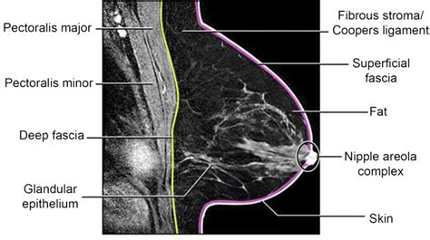 Breast Mr Imaging Magnetic Resonance Imaging Clinics