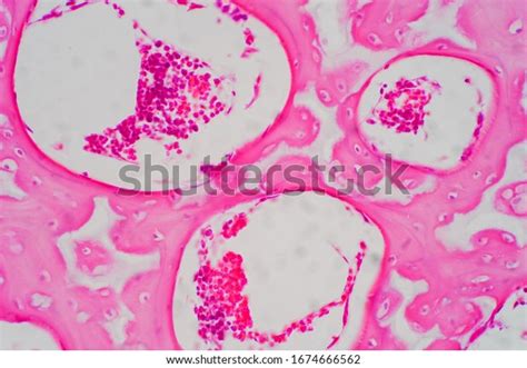 Human Hyaline Cartilage Bone Under Microscope Stock Photo