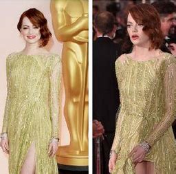 Emma Stone Has Unfortunate Wardrobe Malfunction At Oscars