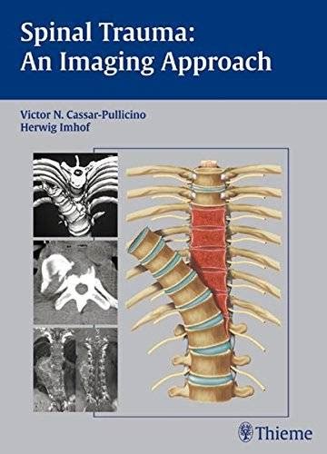 Spinal Trauma An Imaging Approach Medical Books Free
