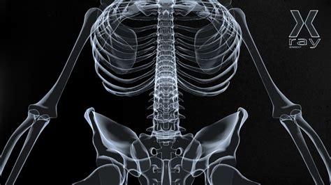 Free Download X Ray Wallpaper 1600x900 For Your Desktop Mobile