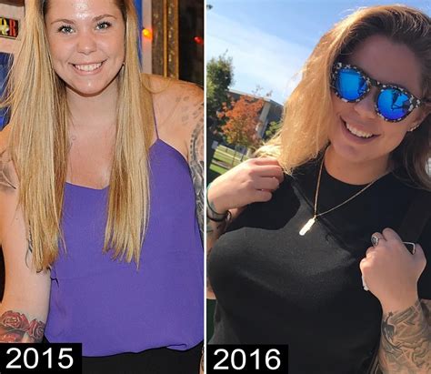 Kail Lowry Plastic Surgery Before After Teen Mom