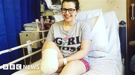 Why I Chose To Have My Leg Amputated Bbc News