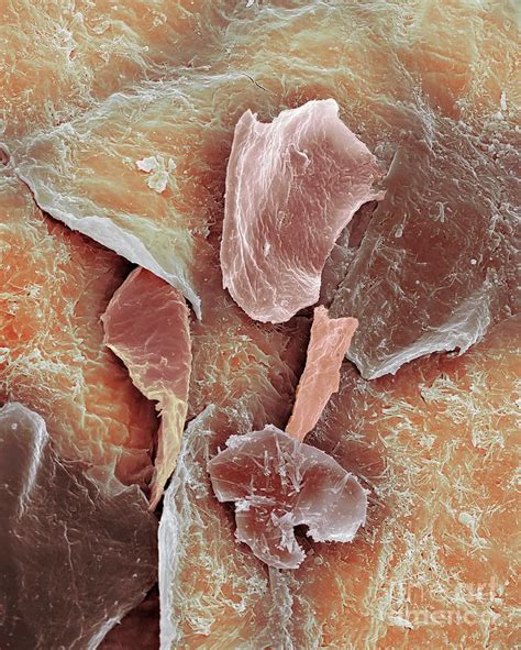 Dead Skin 1 Photograph By Dennis Kunkel Microscopyscience Photo