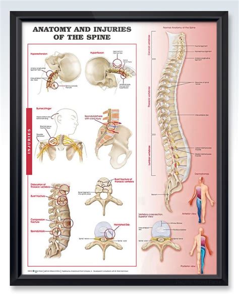 Injuries Of The Spine Exam Room Anatomy Posters Clinicalposters