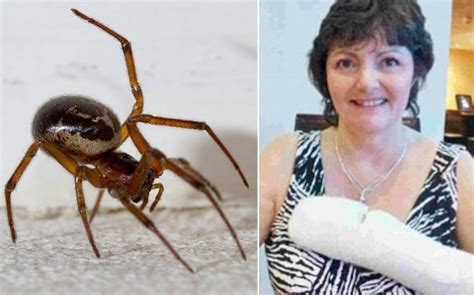 False Black Widow Spider Bite Symptoms Two People In Hospital After False Widow Spider Bites