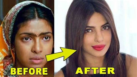 Priyanka chopra started off with winning miss world, made her debut in bollywood but she certainly didn't have plans to just be like any instead of observing her happiness of coming home and how gorgeous she looks in this photograph, fans noticed how priyanka might have undergone a nose job. Priyanka Chopra Plastic Surgery: Nose Job, Lip Fillers, Botox