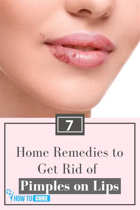 You can read the original writing here: How to Get Rid of Pimple on Lip: 7 Great Home Remedies ...