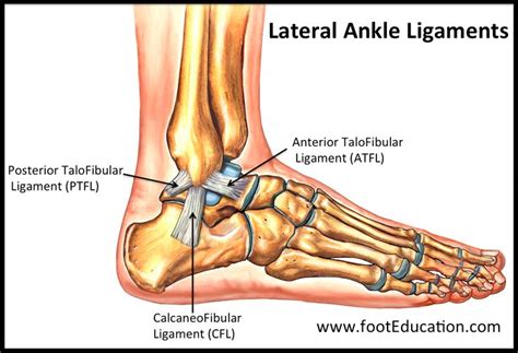 Sprained Ankle Footeducation Sprained Ankle Foot Injury Bones Of