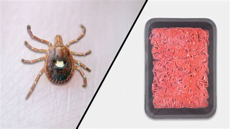 How A Tick Bite Can Give You A Red Meat Allergy Tick Bite Types Of
