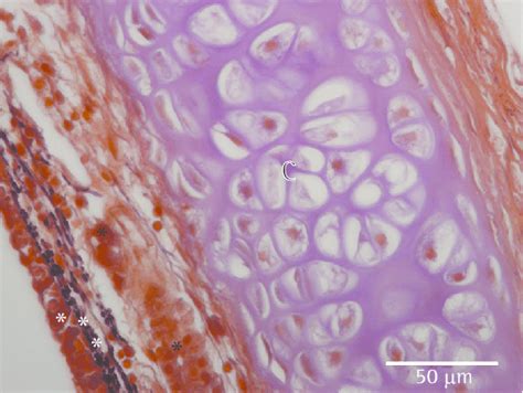 Photomicrograph Of A Tracheal Section Showing The Epithelium Single