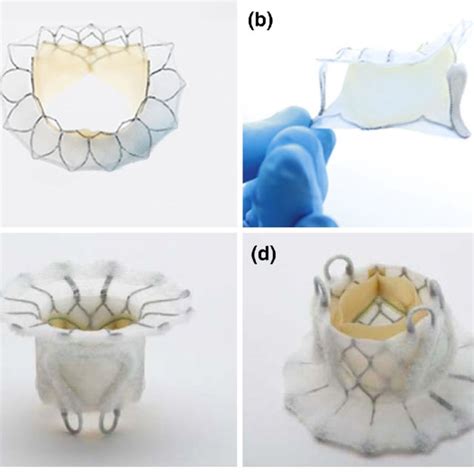 Commercially Available Bioprosthetic Mitral Valves And Annular Rings