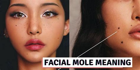 What Does Your Facial Mole Mean Based On Its Location