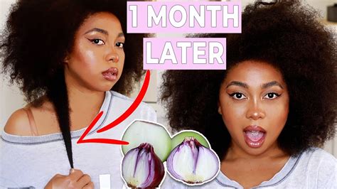 Onion juice for hair growth has received great reviews online onion juice helps improve hair growth by boosting the level of an antioxidant enzyme catalase. ONION JUICE FOR EXTREME HAIR GROWTH? (HOW YOU CAN USE ...