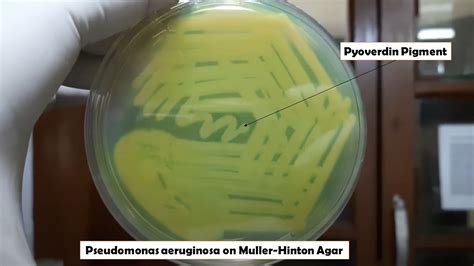 Pyoverdin Pigment Of Pseudomonas Aeruginosa On Muller Hinton Agar Youtube