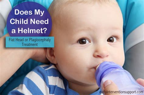 Does My Child Need A Helmet Plagiocephaly Or Flat Head