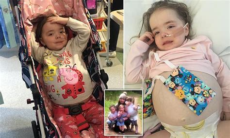 The Two Year Old Who Looks Pregnant Due To A Rare Cancer Daily Mail