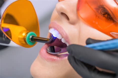 Dental Bonding Southwest Dentistry