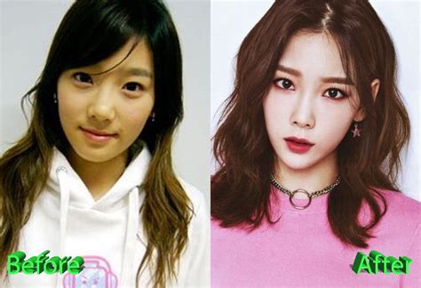 Taeyeon Plastic Surgery Rumors Sparked Off By Recent Snapshots Celebrity Plastic Surgery