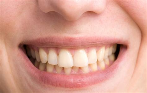 How long did it take to get here? How To Get Yellow Stains Off Teeth