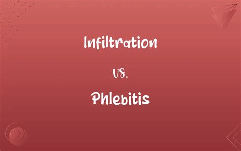 Infiltration Vs Phlebitis Know The Difference