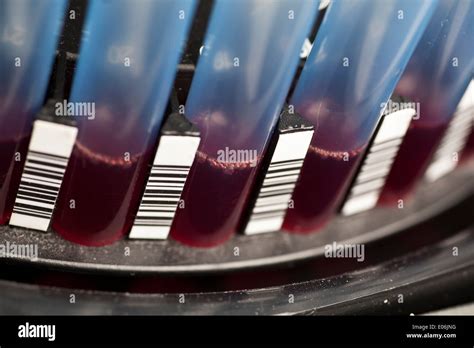 Blood Sample In Laboratory Centrifuge Close Up Stock Photo Alamy