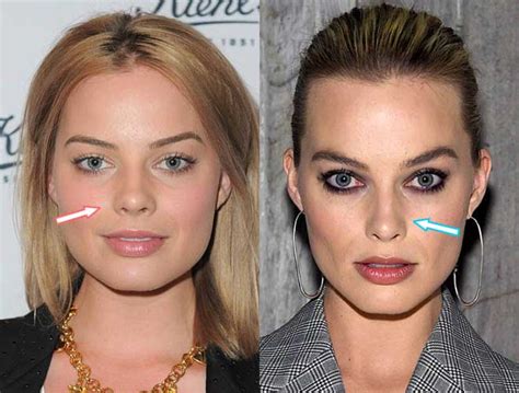 Margot Robbie Plastic Surgery Nose Job Botox Injections Boob Job