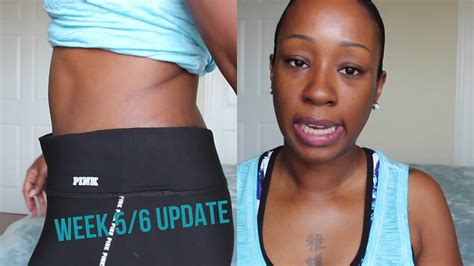 Tummy Tuck Update Week 56 Incisionbelly Button Shots 71415 Youtube