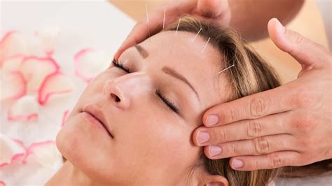 The Benefits Of Acupuncture Treatment 2faceonline