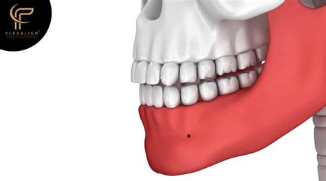Difference Between An Overbite And An Overjet Flexalign