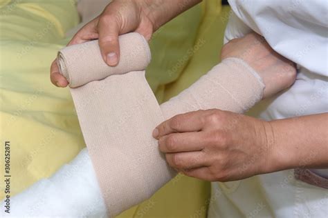 Obraz Lymphedema Management Wrapping Lymphedema Hand And Arm Using