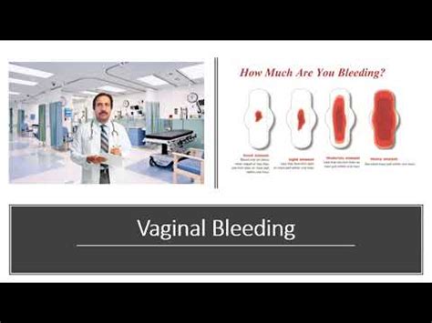 Abnormal Vaginal Bleeding Causes Diagnosis Symptoms Treatment Prognosis YouTube