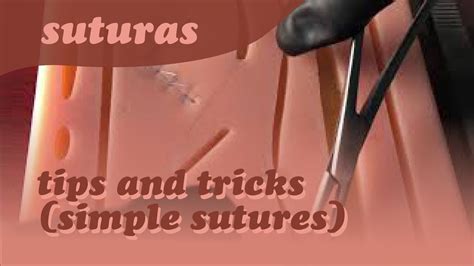 Running Simple Sutures Tips And Tricks Youtube