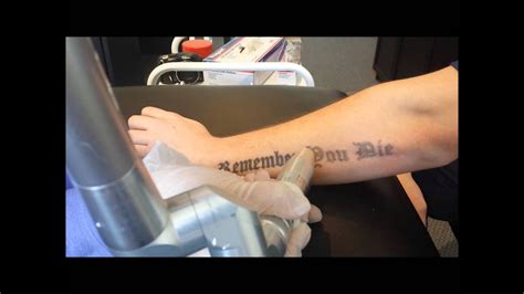 This is our most commonly asked question and the hardest to answer without seeing the tattoo, that is why we offer a free consultation to give you all the information no one, no matter what their degree or their expertise, can say for certain exactly how many sessions it will take to remove your tattoo. Laser Tattoo Removal Forearm 2nd Session - YouTube