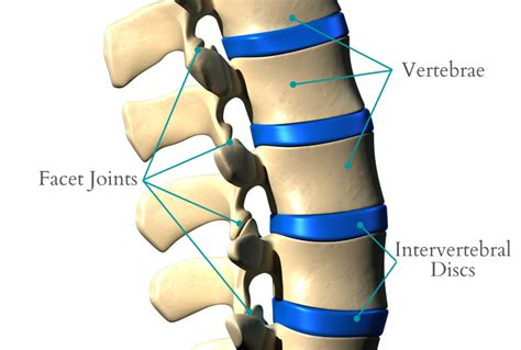 Why Does Facet Joint Degeneration Occur Spinal Backrack