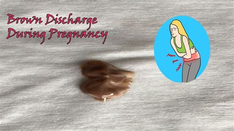 Brown Discharge During Pregnancy Pregnancy Early Pregnancy Spotting
