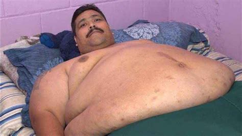 At Nearly 1000 Lbs Worlds Heaviest Man To Undergo Weight Loss Surgery In Mexico Fox News