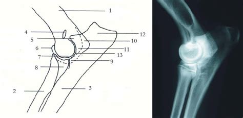 Schematic Drawing And Radiographic Anatomy Of The Elbow Lateral Download Scientific Diagram