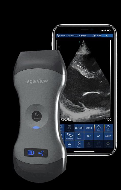 Eagleview Wireless Ultrasound Probes Dual Head Wireless Portable
